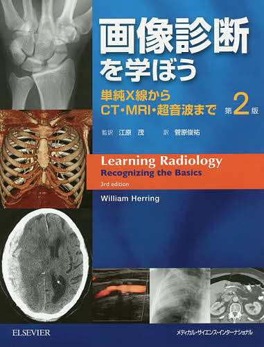 画像診断を学ぼう 単純X線からCT・MRI・超音波まで/ウィリアムヘリング/江原茂/菅原俊祐の通販は