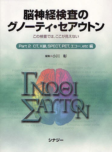 脳神経検査のグノーティ・セアウトン　この検査では，ここが見えない　Ｐａｒｔ２/小川彰