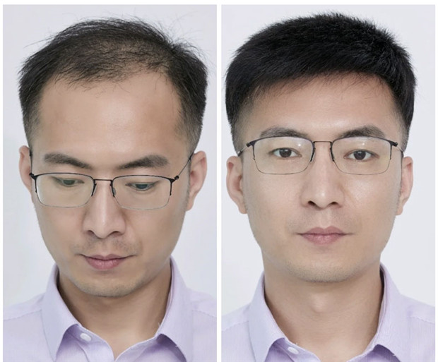 送料無料】部分ウィッグ メンズウィッグ かつら ヘアピース ポイント