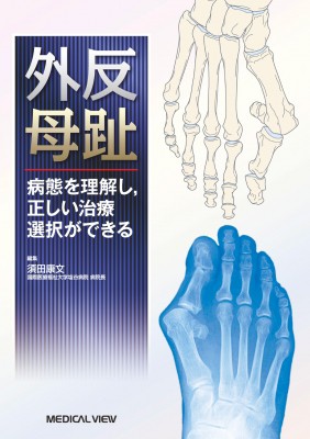 【単行本】 須田康文 / 外反母趾 病態を理解し 正しい治療選択ができる 送料無料