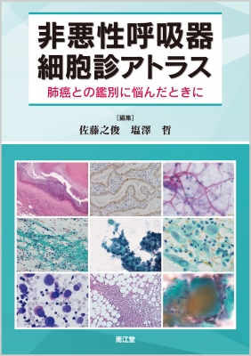 【単行本】 佐藤之俊 / 非悪性呼吸細胞診アトラス 肺癌との鑑別に悩んだときに 送料無料