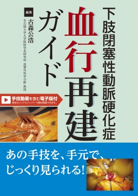 【単行本】 古森公浩 / 下肢閉塞性動脈硬化症　血行再建ガイド 送料無料