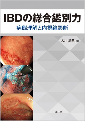 【単行本】 大川清孝 / Ibdの総合鑑別力 病態理解と内視鏡診断 送料無料