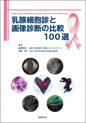 【単行本】 藏本博行 / 乳腺細胞診と画像診断の比較100選 送料無料の通販は