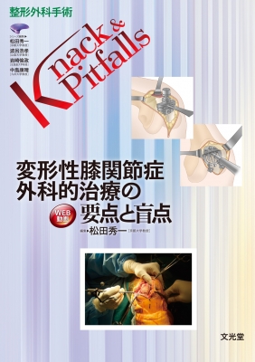 【読みもの】 松田秀一 / うつり変わり性膝つがい目症 外科学的和らげるの心臓部と視神経円板 整形外科学外科手術knack  &  Pitfalls 貨物輸送無料