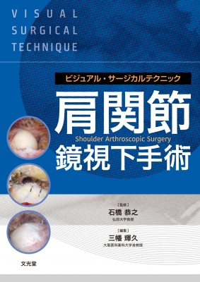 【単行本】 石橋恭之 / 肩関節鏡視下手術 ビジュアル・サージカルテクニック 送料無料の通販は