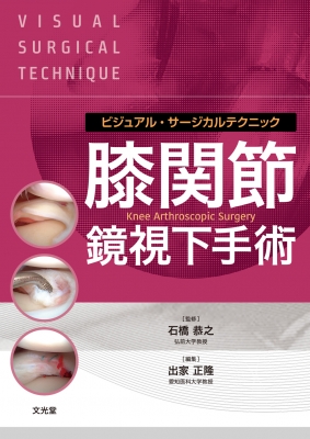 【単行本】 石橋恭之 / 膝関節鏡視下手術 ビジュアル・サージカルテクニック 送料無料の通販は