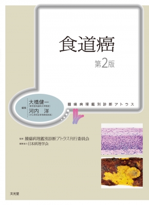 乳癌 腫瘍病理鑑別診断アトラス 第2版 乳癌 腫瘍病理鑑別診断アトラス 第2版