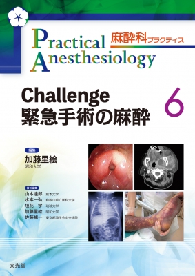 【単行本】 加藤里絵 / Challenge 緊急手術の麻酔 麻酔科プラクティス 送料無料の通販は