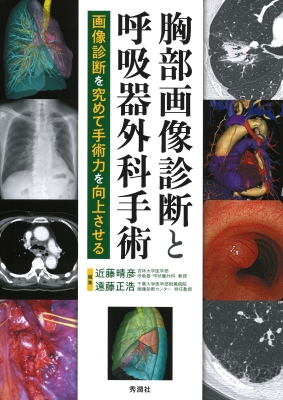 【単行本】 近藤晴彦 / 胸部画像診断と呼吸器外科手術 画像診断を究めて手術力を向上させる 送料無料