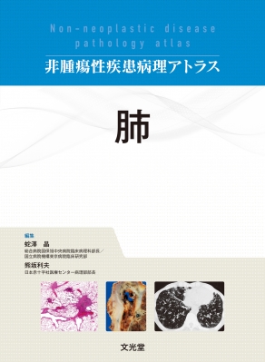 【単行本】 蛇澤晶 / 肺 非腫瘍性疾患病理アトラス 送料無料