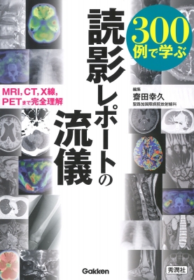 【単行本】 齋田幸久 / 300例で学ぶ読影レポートの流儀 MRI、CT、X線、PETまで完全理解 送料無料の通販は 5,524円
