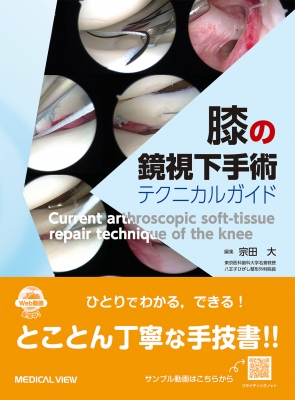 【読みもの】 宗田大 / 膝の鏡視下外科手術 テクニカルガイド 貨物輸送無料