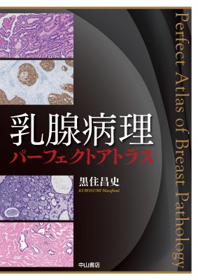 【単行本】 黒住昌史 / 乳腺病理パーフェクトアトラス 送料無料の通販は