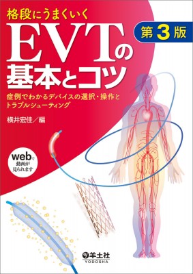 【単行本】 横井宏佳 / 格段にうまくいくEVTの基本とコツ 症例でわかるデバイスの選択・操作とトラブルシューティング 送料無