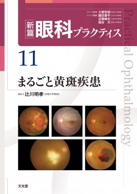【読みもの】 辻川明孝 / 新篇眼科訓連 11 まるごと黄斑病み煩い 貨物輸送無料