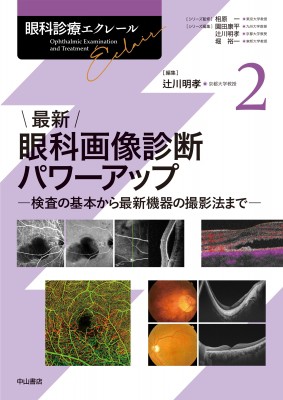 【全集・双書】 辻川明孝 / 最新　眼科画像診断パワーアップ 眼科診療エクレール 送料無料