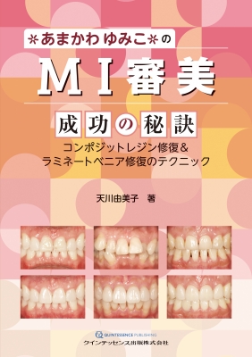 【単行本】 天川由美子 / あまかわゆみこのMI審美成功の秘訣 コンポジットレジン修復 &amp; ラミネートベニア修復のテクニック 送