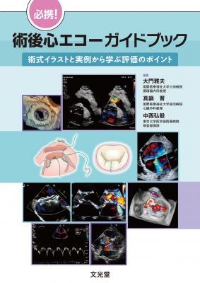 【単行本】 大門雅夫 / 必携!術後心エコーガイドブック 術式イラストと実例から学ぶ評価のポイント 送料無料