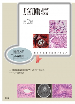 【単行本】 横尾英明 / 脳腫瘍 腫瘍病理鑑別診断アトラス 送料無料