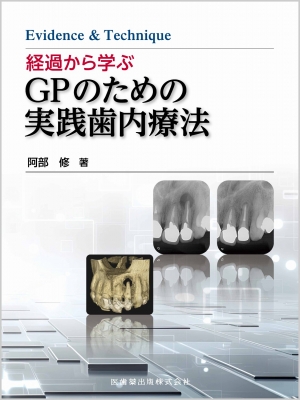 【読みもの】 阿部修 / Evidence  &  Technique くぐり抜けるから学ぶGPの目的の当て嵌める歯内治療法 貨物輸送無料