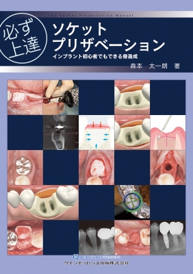 【単行本】 森本太一朗 / 必ず上達 ソケットプリザベーション インプラント初心者でもできる骨造成 必ず上達シリーズ 送料無料