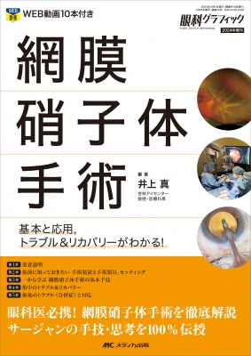 眼科グラフィック2024増刊　網膜硝子体手術　裁断済み 単行本】 メディカ出版 / 網膜硝子体手術 眼科グラフィック 2024年増刊