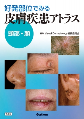 【単行本】 Visualdermatology編集委員会 / 好発部位でみる皮膚疾患アトラス 頭部・顔 頭頚部 送料無料の通販は