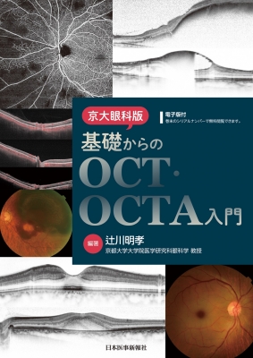 【単行本】 辻川明孝 / 京大眼科版 基礎からのOCT・OCTA入門 送料無料