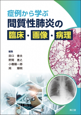 【読みもの】 田口善夫 / 症例から学ぶ 間質性肺炎の臨床・すがた絵・病理学 貨物輸送無料