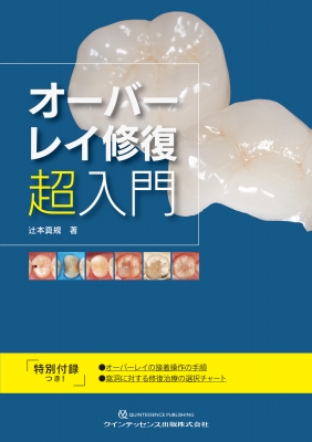 【単行本】 辻本真規 / オーバーレイ修復 超入門 送料無料