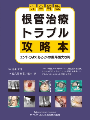 【単行本】 月星太介 / 完全解説 根管治療トラブル攻略本 エンドのよくある24の難局面大攻略 送料無料