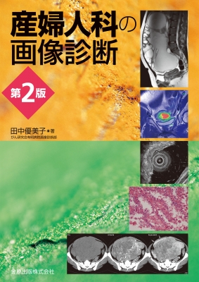 【単行本】 田中優美子 / 産婦人科の画像診断 第2版 送料無料