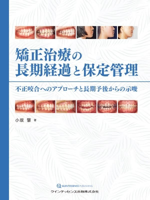 【単行本】 小坂肇 / 矯正治療の長期経過と保定管理 不正咬合へのアプローチと長期予後からの示唆 送料無料