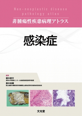 【単行本】 栃木直文 / 感染症 非腫瘍性疾患病理アトラス 送料無料