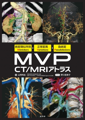【単行本】 山岡利成 / 病変類似所見Mimickers・正常変異Variations・偽病変Pseudolesions MVP CT  /  MRIアトラス 送料無料