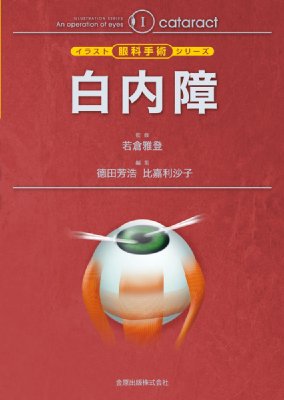 【単行本】 徳田芳浩 / 白内障 イラスト眼科手術シリーズ 送料無料