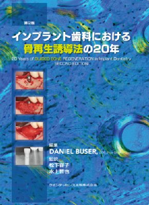 【単行本】 Daniel Buser / インプラント歯科における骨再生誘導法の20年 送料無料