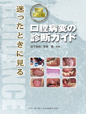 【単行本】 坂下英明 / 増補改訂版迷ったときに見る口腔病変の診断ガイド 送料無料 6,437円