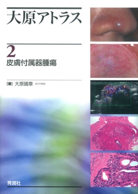 【単行本】 大原國章 / 大原アトラス 2 皮膚付属器腫瘍 送料無料 11,242円