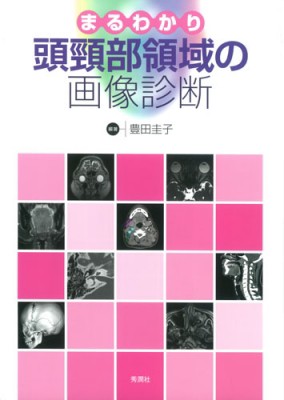 まるわかり頭頸部領域の画像診断 | 豊田 圭子 |本 | 通販 | Amazon
