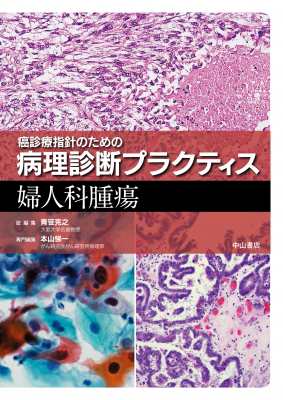 【全集・双書】 青笹克之 / 癌診療指針のための病理診断プラクティス　婦人科腫瘍 送料無料