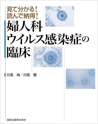 【単行本】 川名尚 / 見て分かる!読んで納得!婦人科ウイルス感染の臨床 送料無料の通販は 9,504円