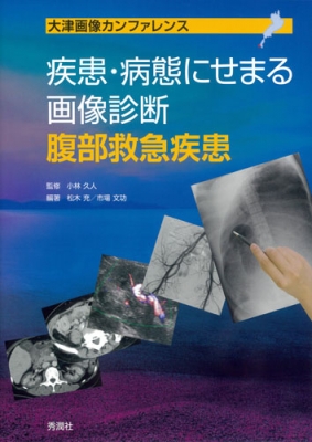 【単行本】 小林久人 / 疾患・病態にせまる画像診断腹部救急疾患 疾患・病態にせまる画像診断腹部救急疾患 大津画像カンファレ