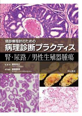 【単行本】 青笹克之 / 癌診療指針のための病理診断プラクティス　腎・尿路 / 男性生殖器腫瘍 送料無料