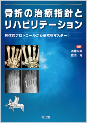 【単行本】 酒井昭典 / 骨折の治療指針とリハビリテーション 具体的プロトコールから基本をマスター! 送料無料 6,826円