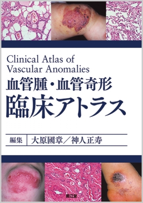 【単行本】 大原國章 / 血管腫・血管奇形　臨床アトラス 送料無料