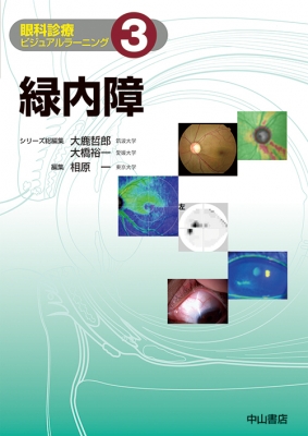 【全集・叢書】 相原一 / 緑内障 眼科見立てビジュアルラーニング 貨物輸送無料