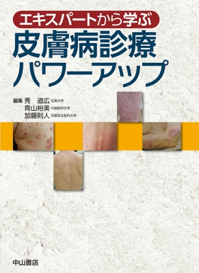 【単行本】 秀道広 / エキスパートから学ぶ皮膚病診療パワーアップ 送料無料