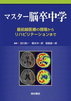 【単行本】 田川皓一 / マスター脳卒中学 最前線医療の現場からリハビリテーションまで 送料無料